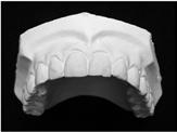 Classificação das faces: Incisal