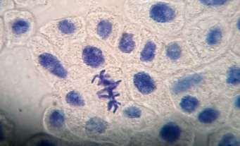 Figura 1. Células meristemáticas da raíz de Allium cepa. A maioria das células observadas não se encontravam em divisão celular.