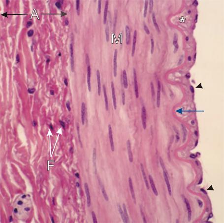 Estrutura da parede de artéria muscular coloração H&E coloração elastina I)