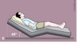 Cuidados Gerais NE domiciliar Posição para infusão: cabeceira elevada a 45º ou sentado Permanecer durante 30 minutos após a infusão Siga o plano dietoterápico estabelecido em