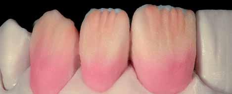 61 As Dentinas de Mamelo são aplicadas na massa Value e Fig.