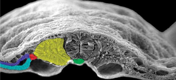 Diferenciação da mesoderme Tubo neural TN notocorda Mesoderma paraxial