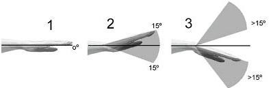 Figura 4- Posições que modificam a pontuação do antebraço Punhos: para estes devem