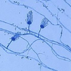 Deuteromycota Atualmente inexistente Reagrupados em ascomycota ou basidiomycota Fungos mitospóricos ou anamórficos Reprodução assexuada por