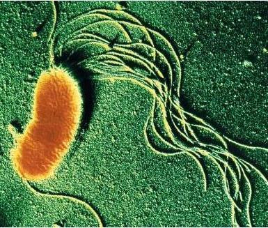 ARCHAEA x BACTERIA X Constituição da parede celular: arquea polissacarídeos