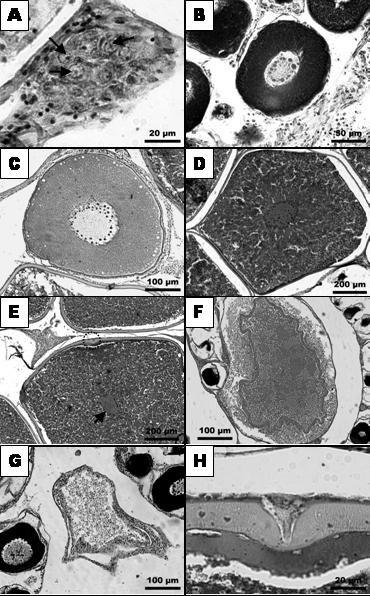 Resultados 31 FIGURA 7: Fotomicrografias de secções de ovários de S. hilarii coletados no rio Sorocaba, SP, nas diferentes fases de desenvolvimento ovocitário: A) Cromatina-nucléolo (setas).