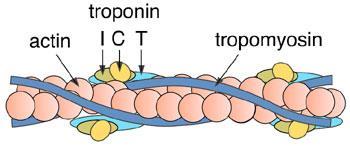 BIOMARCADORES nos SCA Troponina Complexo de 3 proteínas regulatórias troponina C, I e T - associadas com a contracção muscular no