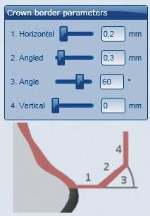 APLICAÇÃO Parâmetros das bordas no software CAD de Ceramill Mind Deve se prestar atenção em Ceramill Zolid Preshades, para que as espessuras das bordas sejam suficientes.