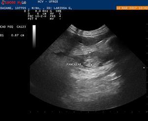 Página 8 Figura 3. Ultrassonografia de pâncreas.