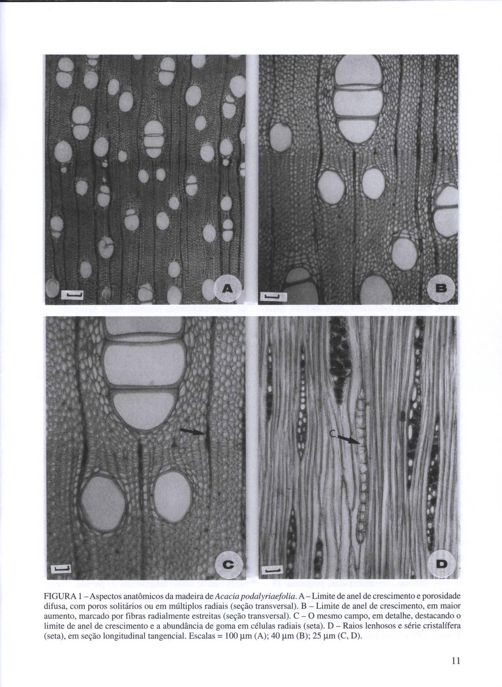 FIGURA I - Aspectos anatômicos da madeira de Acaeia podalyriaefolia. A - Limite de anel de crescimento e porosidade difusa, com poros solitários ou em múltiplos radiais (seção transversal).