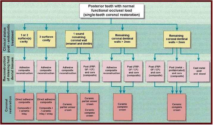 Fig. 6 Possibilidades de restauração de dentes posteriores (Vârtan et al., 2009) D. Parâmetros de avaliação dos espigões 1.