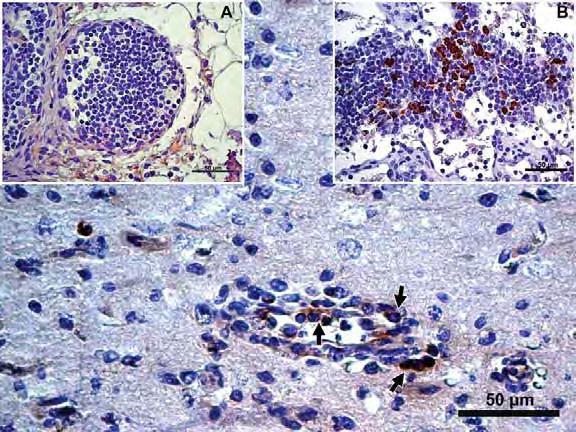 24 Após analisar a presença de Linfócitos T no encéfalo do coelho mediante a detecção do antígeno CD 3 na superfície celular, observou-se que nas áreas 1 e 2 dentro do fragmento do encéfalo, este