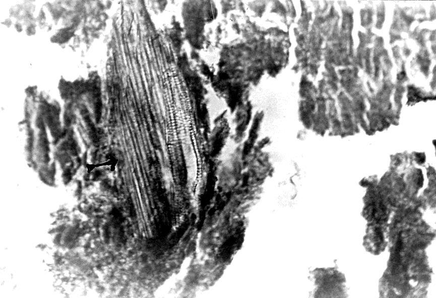 ovos de Ascaris lumbricoides. FIGURA 2 (x 250 H.E.