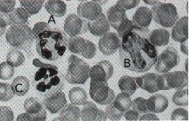 Ficha de Treino FT SC9 1. Observa a figura seguinte que representa um esfregaço sanguíneo visto ao microscópio. 1.1. Identifica as letras da figura. 1.2. Qual o constituinte do sangue que: 1.2.1 ocupa a maior parte do seu volume?