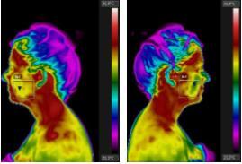 Figura 8a Região com temperatura máxima de 36,0 C e temperatura mínima de 33,2 C. Figura 8b Região com temperatura máxima de 35,9 C e temperatura mínima de 32,4 C. 4.