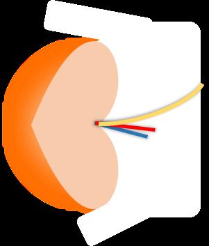 Função renal residual (%) 30 20