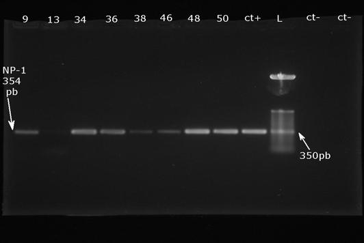 MÉTODOS 47 3.6.8 Identificação do bocavírus humano (hbov). PCR qualitativo As reações de PCR foram realizadas com primers direcionados para a região conservada NP-1 do genoma viral.