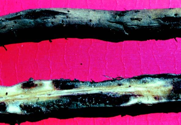 Foto: Dilson da Cunha Costa Fig. 10.1. Lesões radiculares internas causadas por Radopholus similis. 10.2.