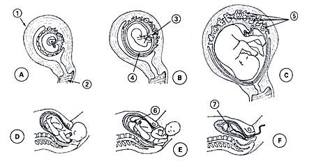 17. (UFMG) Observe as figuras referentes a algumas etapas da gestação humana, A, B e C, e do parto, D, E e F, em que algumas estruturas foram indicadas por números de 1 a 7.