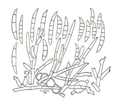 ) Fusarium graminearum; ) Conidióforos, conídios, ascas,