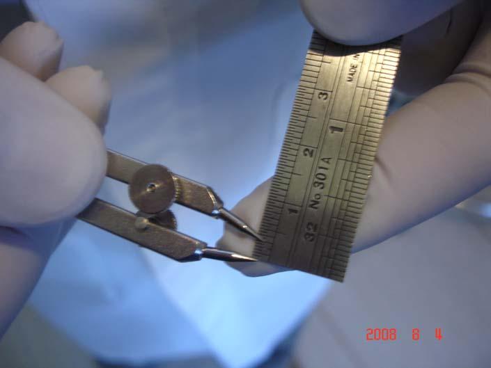 39 Figura 3 Medida no compasso de ponta seca da distância entre a borda incisal do incisivo inferior e a marcação feita a lápis na sua vestibular.