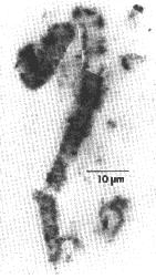 Bactérias fósseis em estromatólitos Bactérias