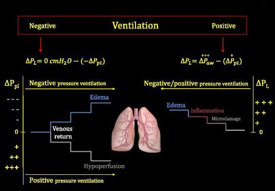 VENTILAÇÃO MECÂNICA EFEITOS ADVERSOS DEVIDOS À PRESSÃO TRANSPULMONAR E À VARIAÇÃO DA PRESSÃO PLEURAL Negativo Ventilação Positivo Ventilação com pressão