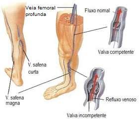 Figura 1: Principais veias do sistema venoso periférico (adaptado de http://www.medicinageriatrica.com.