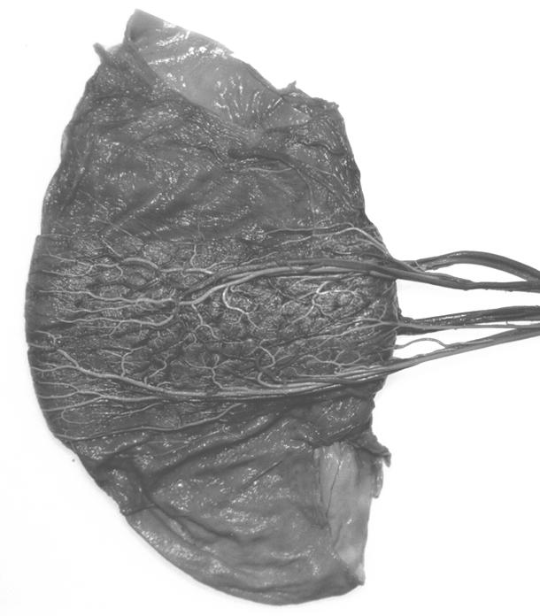 maternomaterno-fetal Cotiledonária Zonária Zonária