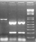 54 1 2 3 M 1000 bp 400 bp 300 bp 200 bp 100 bp Figura 12: Restrição enzimática com TaqI. 1: B. tuberculata / P.