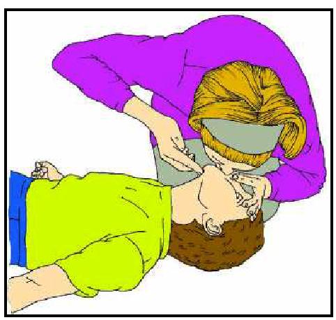 6) Comprobe se a vítima respira (fágao durante, polo menos, 5 segundos, pero non máis de dez segundos). Vexa, oia e sinta a respiración.