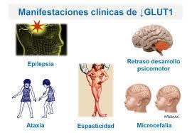 Epilepsia de início precoce Outros ep. paroxísticos Ataxia intermitente, sonolência, hemiparésia alternante, alt.