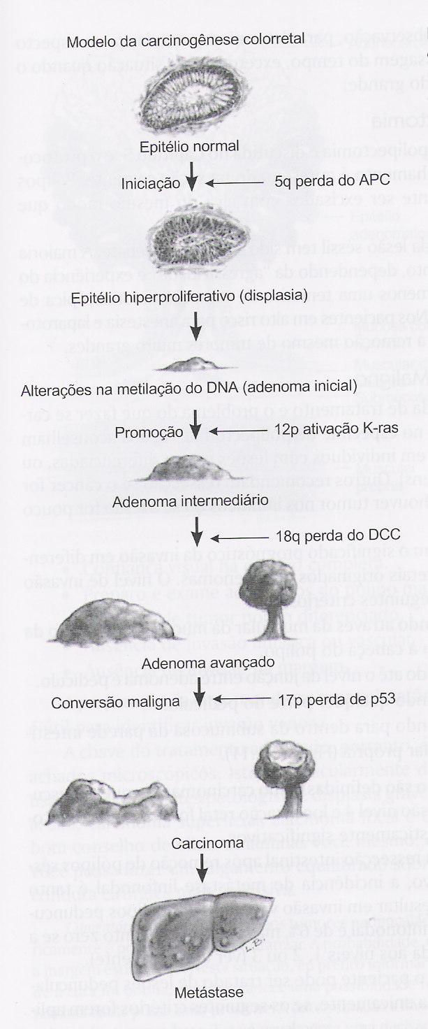 CARCINOGÊNESE COLORRETAL Adenoma inicial Adenoma intermediário