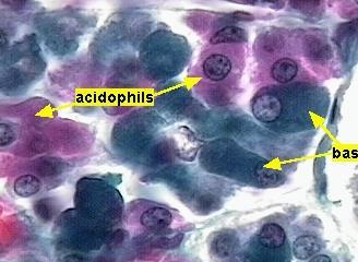 Pars distalis Células Basófilas 4 tipos de células basófilas acidófilas basófilas Gonadotróficas Hormônio folículoestimulante (FSH) Hormônio