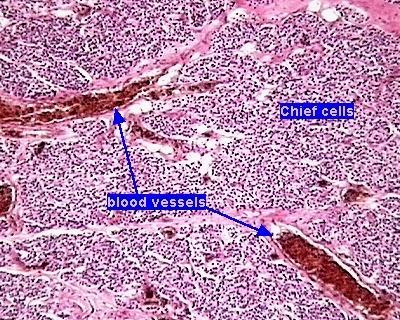 Paratireóides Cápsula Células Principais Vasos Sanguíneos Células principais: Produzem hormônio paratiereoidiano Aumenta a concentração de cálcio no sangue