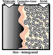 Integração óssea óssea Integração