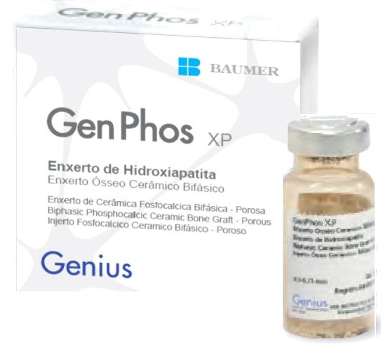 GenPhos XP GenPhos XP pertence a família da GenPhos HA TCP cerâmicas de fosfato de cálcio composta por Hidroxiapatita e βtrifosfato