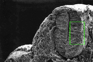 neural truncal formará o