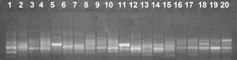 obtidos a partir da técnica de PCR-ARISA foram analisados, quanto a sua qualidade, em eletroforese em gel de agarose, apresentando-se de boa qualidade, conforme o perfil dos amplicons da Figura 2.