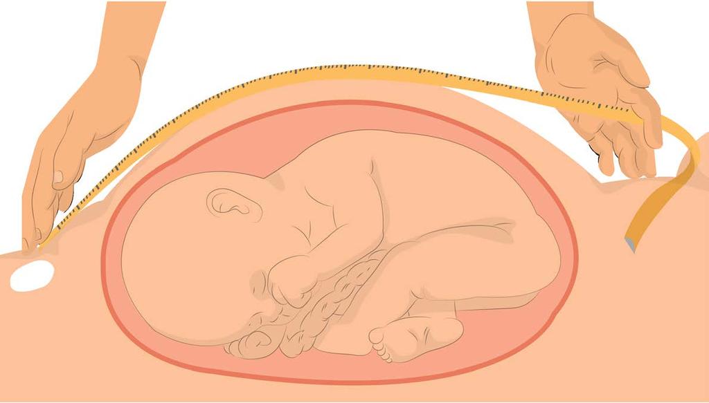 Pela Regra de Näegele, deve-se somar sete dias ao primeiro dia da última menstruação e subtrair três meses ao mês em que ocorreu a última menstruação.