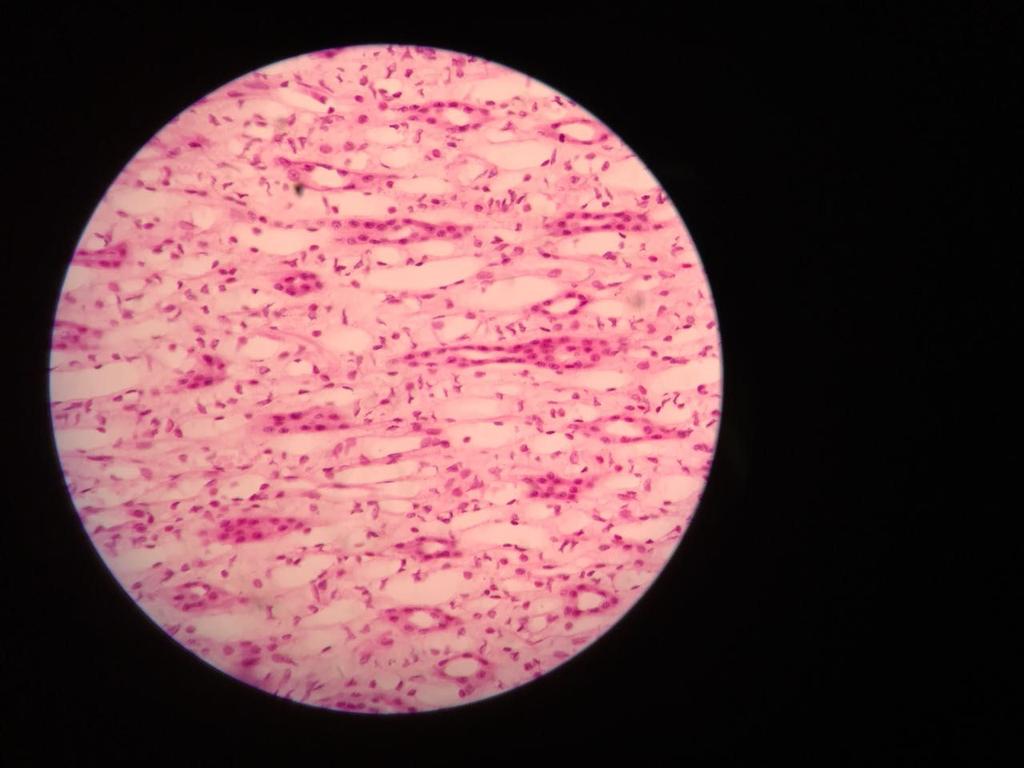 Rim= Q1 Região Medular Túbulos coletores (epitélio plano cúbico simples, células com citoplasma claro e núcleos