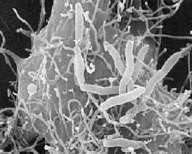 Aeromonas hydrophila Característica do microrganismo Família Vibrionaceae Bacilo Gram negativo