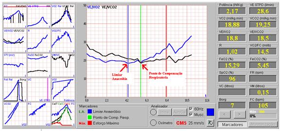 FC Frequência Cardíaca; PAS/PAD Pressão arterial sistólica e pressão arterial Diastólica; ST Segmento STY ; DP Duplo Produto; 4. Clique em OK para sair da tela.
