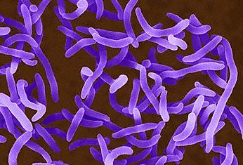 Outros bastonetes Gram- de importância no TGI Vibrio cholerae Bacilos Gram-negativos, em forma de vírgula