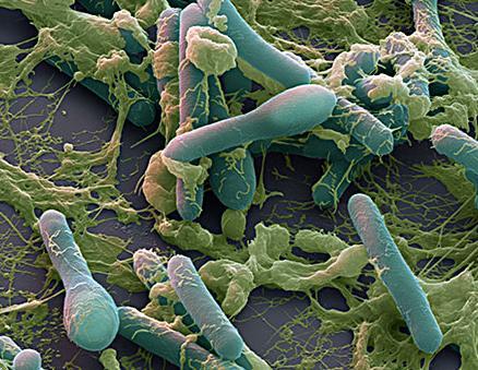 Bactérias Gram-positivas formadoras de endósporos Clostridium botulinum Agente etiológico do botulismo Amplamente