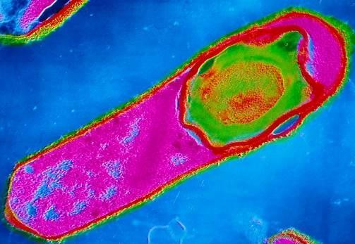 Clostridium perfringens Um dos agentes mais frequentemente envolvidos em surtos de toxinfecções alimentares, no mundo, perdendo apenas para salmoneloses.