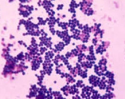 Bactérias Gram-positivas não formadoras de endósporos Staphylococcus aureus Doenças Invasão direta e destruição tecidual infecções