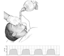 ausculta pulmonar, capnógrafo,