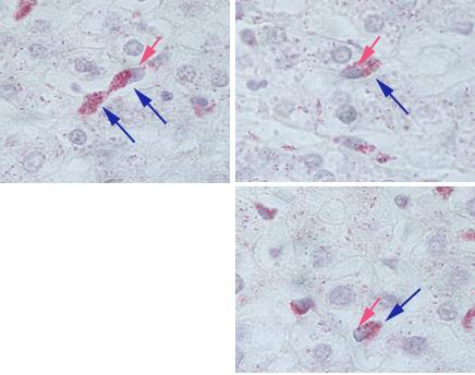 Células do tecido conjuntivo Macrófago e sistema mononuclear Célula-tronco hematopoiética (Medula óssea) (Célula sanguínea) Atravessam as paredes das veias e capilares, penetrando no tecido