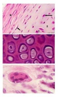 Tecido conjuntivo - cartilaginoso Condroblastos: dá origem a matriz e ao tecido cartilaginoso. Condrócitos: derivada dos condroblastos.